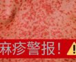 麻疹警报