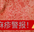 麻疹警报